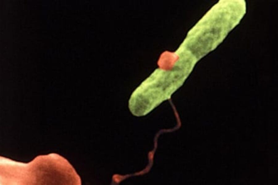 Illustrasjonsfoto av legionella.