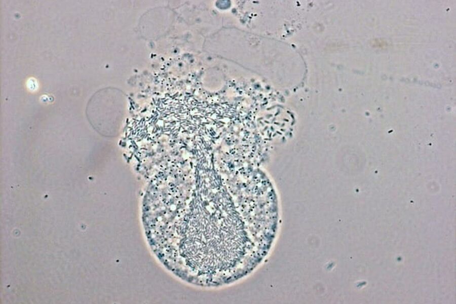 I vannprøver fra norske marinefartøy ble det funnet amøber med levende legionella-bakterier. Bildet er fra et laboratorieforsøk som viser hvordan legionellabakterier frigjøres etter at de har fått amøben til å sprekke. Foto: Forsvarets forskningsinstitutt (FFI) 