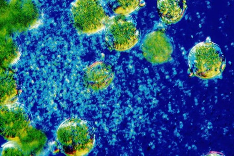 Små svevepartikler og større organiske partikler som normalt er til stede i luft: Foto Lennart Nilsson/Camfil