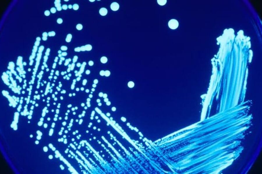 Legionellbakterier trives i vann opp mot 50 grader pluss.