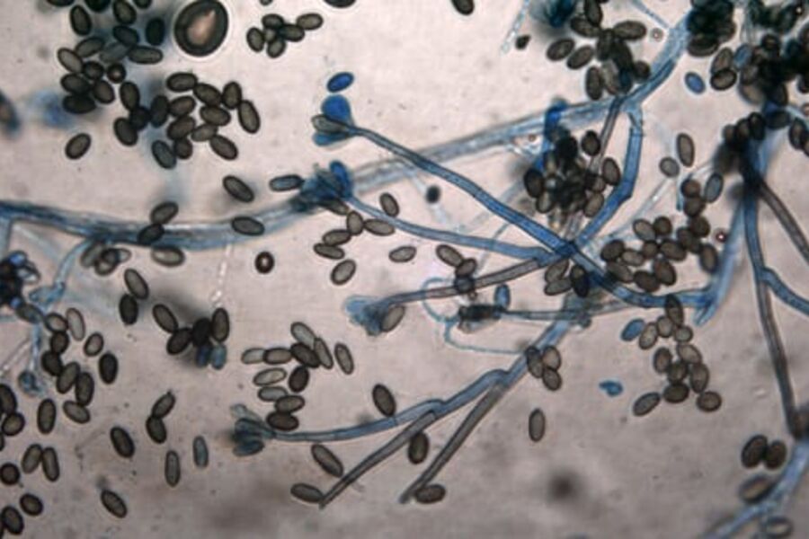 Stachybotrys chartarum. Foto: Mycoteam