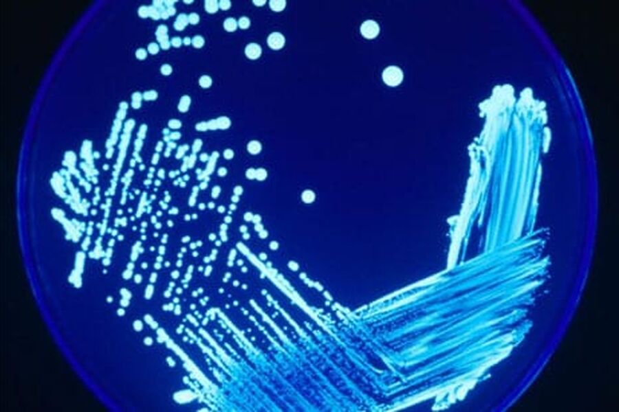 En Legionella-kultur under ultrafiolett lys.