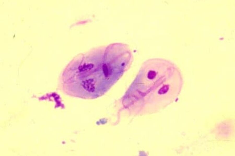 Slik ser Giardia Lamblia ut - en miroorganisme som ikke er særlig hyggelig å få i maven.