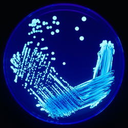 En Legionella-kultur under ultrafiolett lys